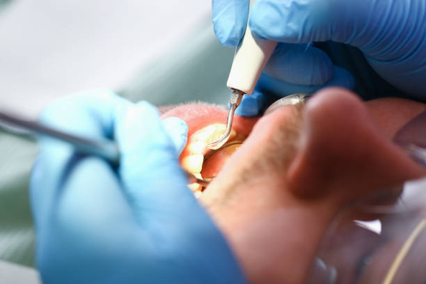 Best Broken or Chipped Tooth Repair in Pea Ridge, WV