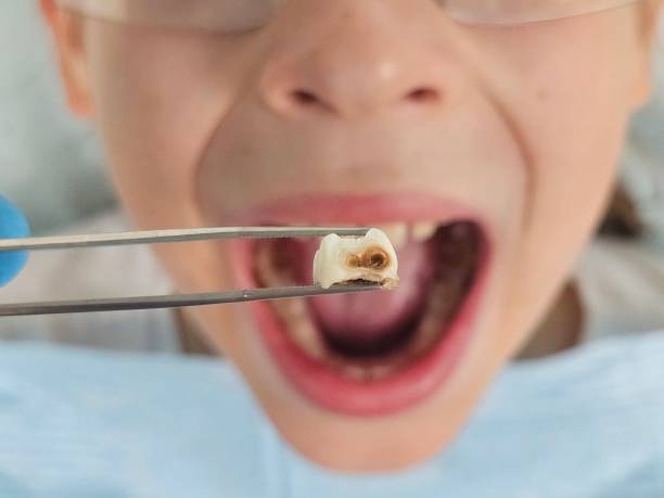 Best Walk-In Emergency Dental Services in Pea Ridge, WV