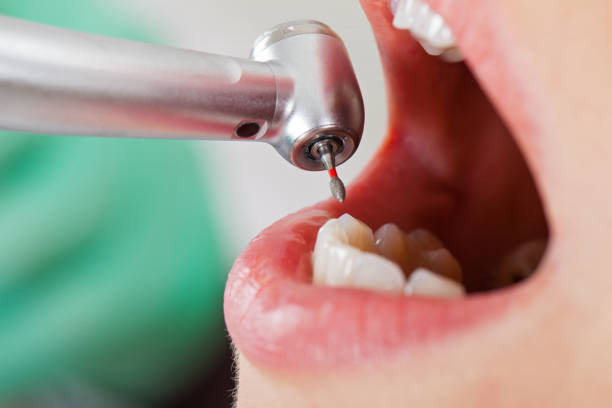 Best Dental Abscess Treatment in Pea Ridge, WV
